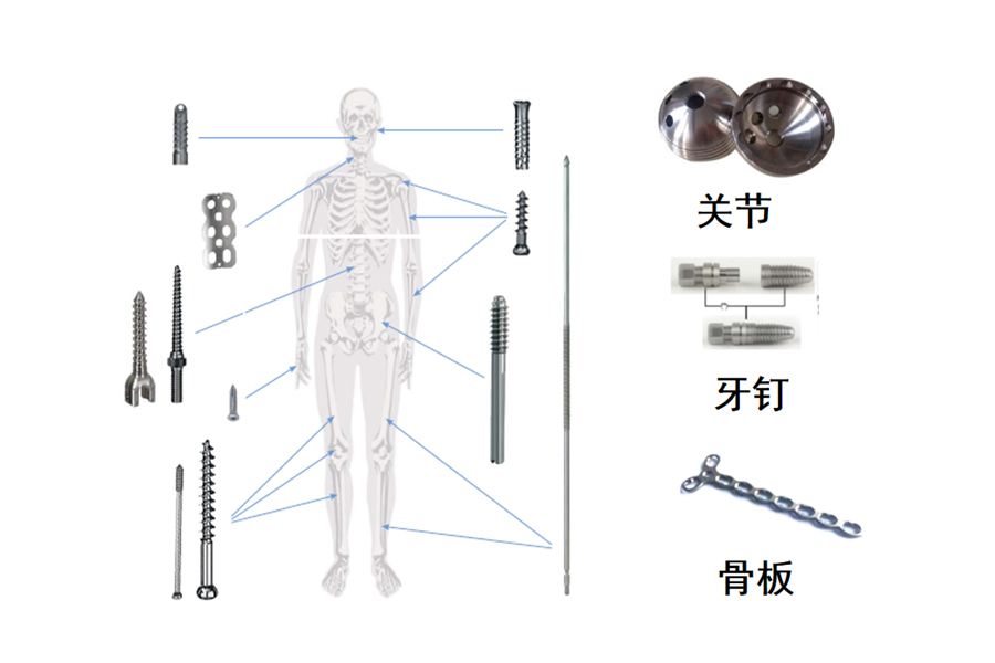 医疗骨科、牙钉、脊椎